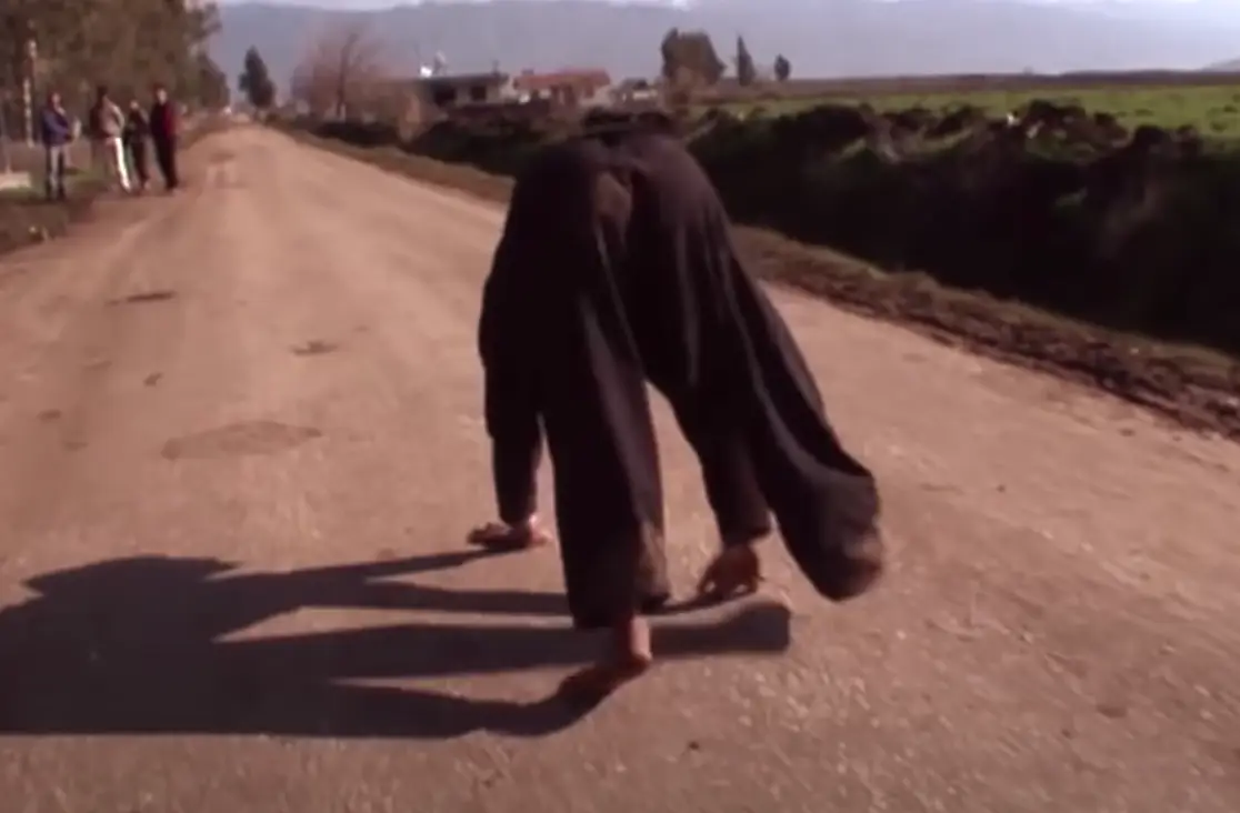 Six out of 18 of the children in the Ulas family were found to have the condition.