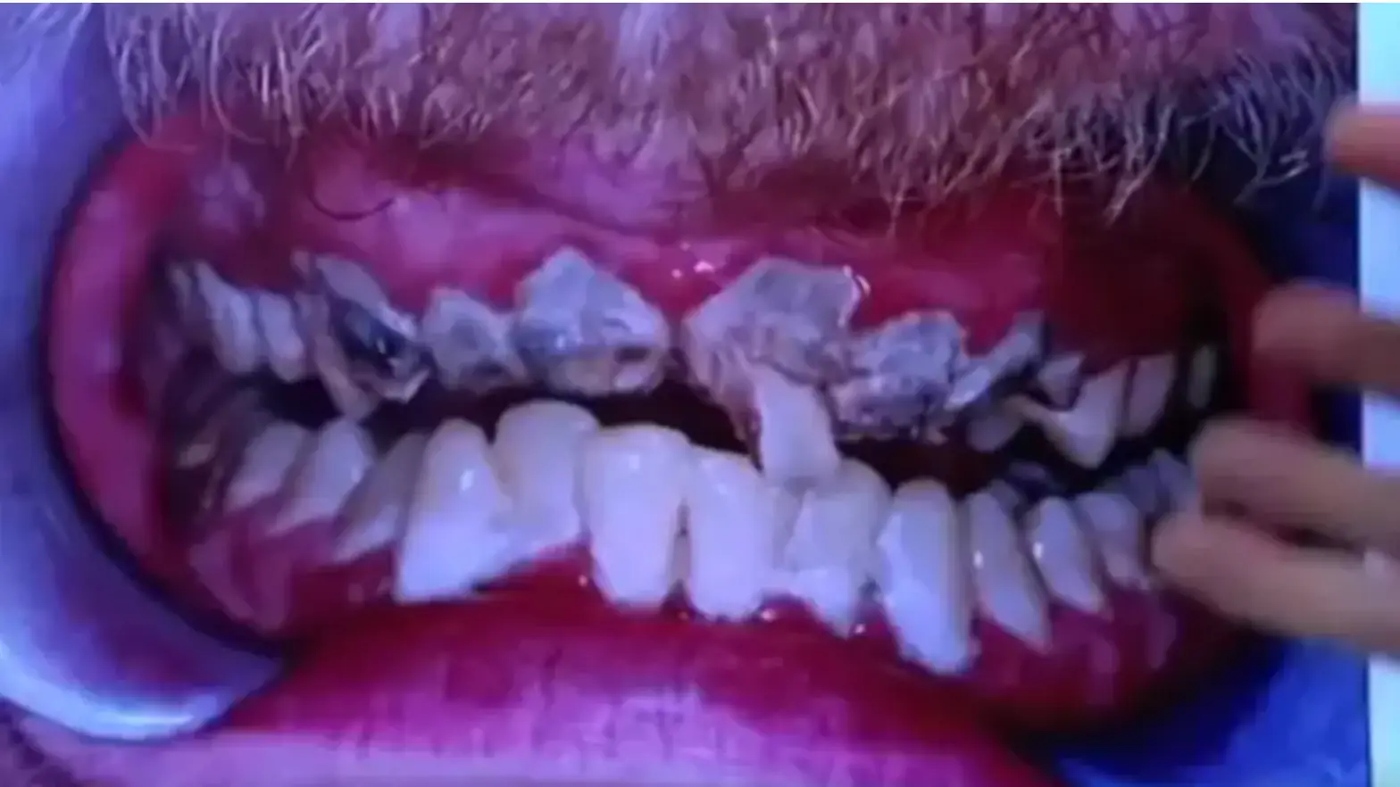 Jay had a diet of fizzy drinks. Credit:Channel 4/Embarrassing Bodies