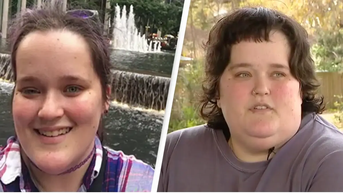 Woman receives life-changing diagnosis after noticing her eye drooping in selfie