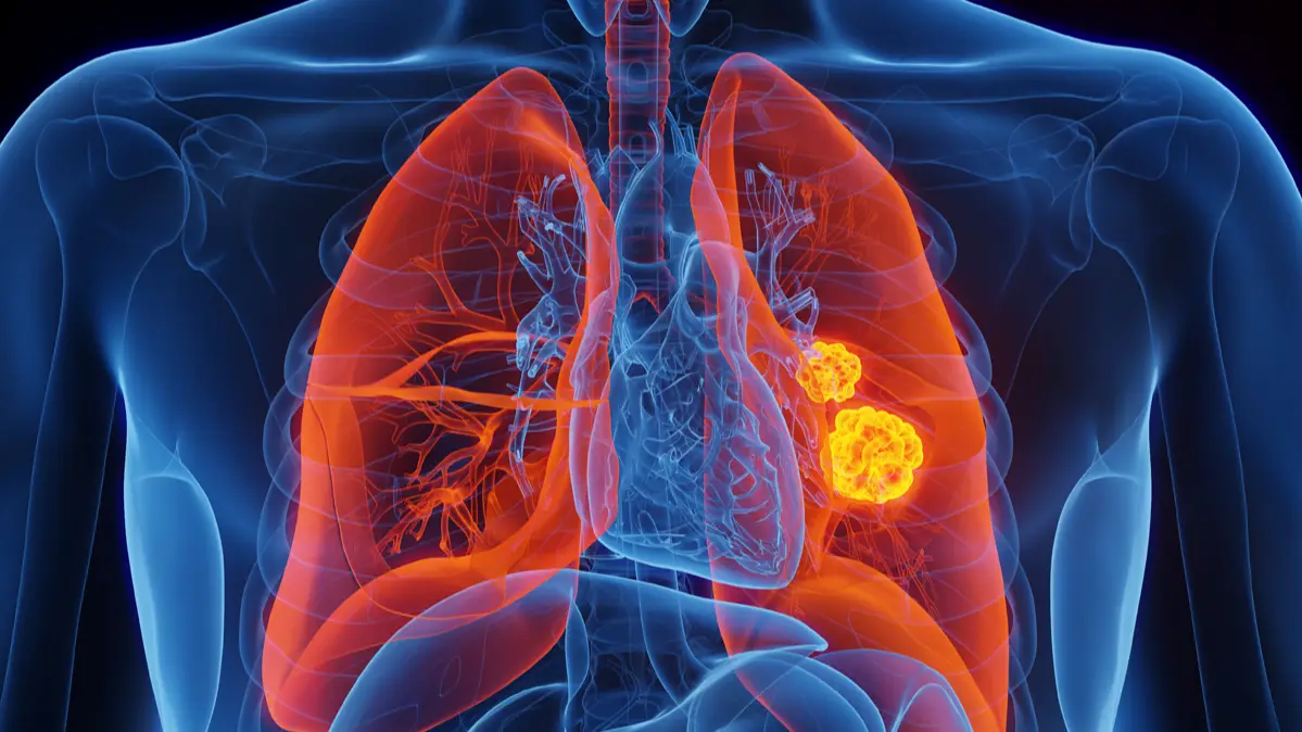 Getty Images/SEBASTIAN KAULITZKI/SCIENCE PHOTO LIBRARY