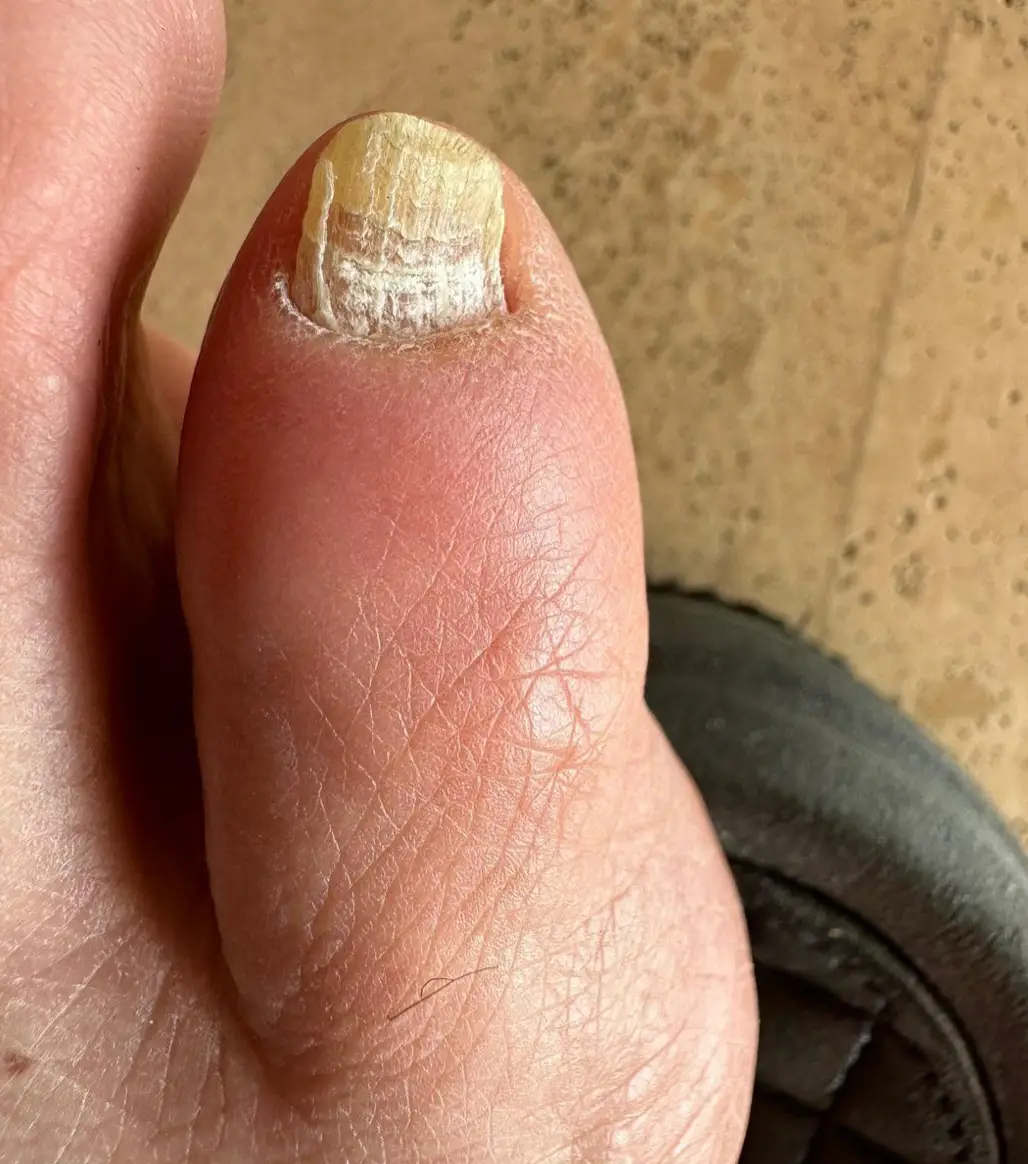 The offending foot has caused concern online.