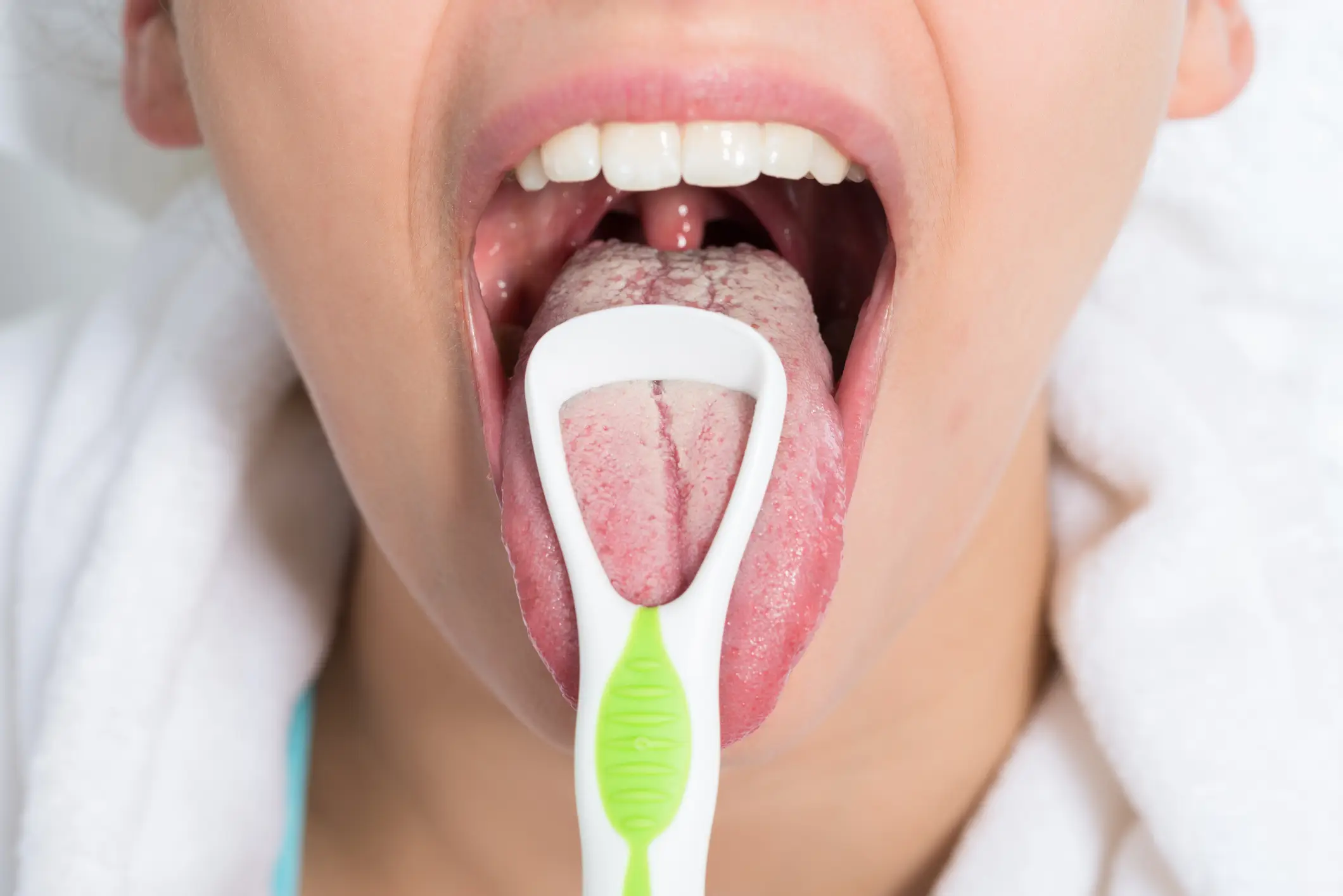 Gentle tongue scraping can help remove coating linked to black hairy tongue (AndreyPopov/Getty Images)