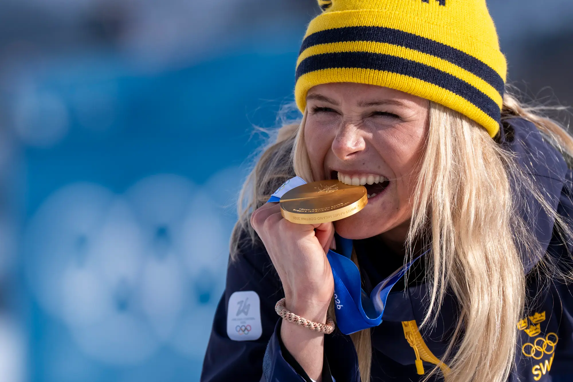 Perhaps they need to roll out a bite test? (Andrzej Iwanczuk/NurPhoto via Getty Images)