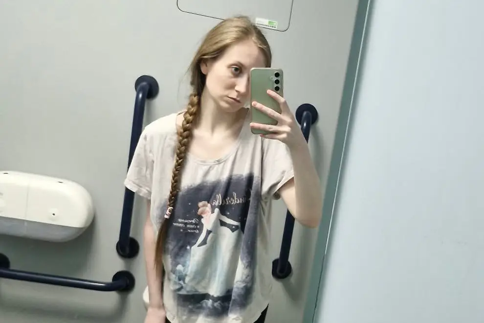 The Brit has lost an unhealthy amount of weight because of her condition (SWNS)