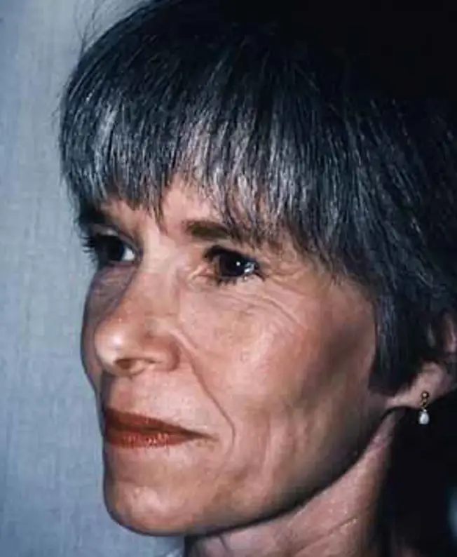 Gwyn Sirota spent less time in the sun (Darrick E. Antell, M.D)