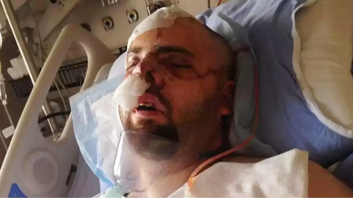 Bear attack survivor wrote chilling final note to loved ones after picking up pieces of his own flesh