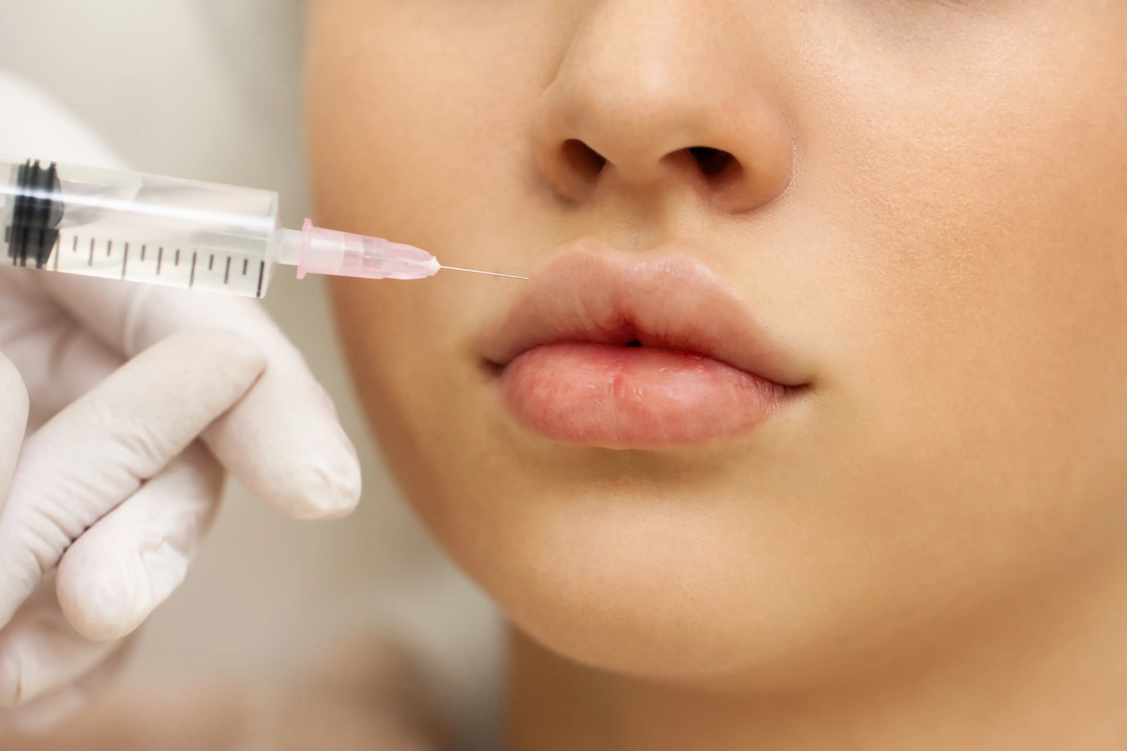 Lip fillers are a hugely popular procedure (Getty Stock Image)