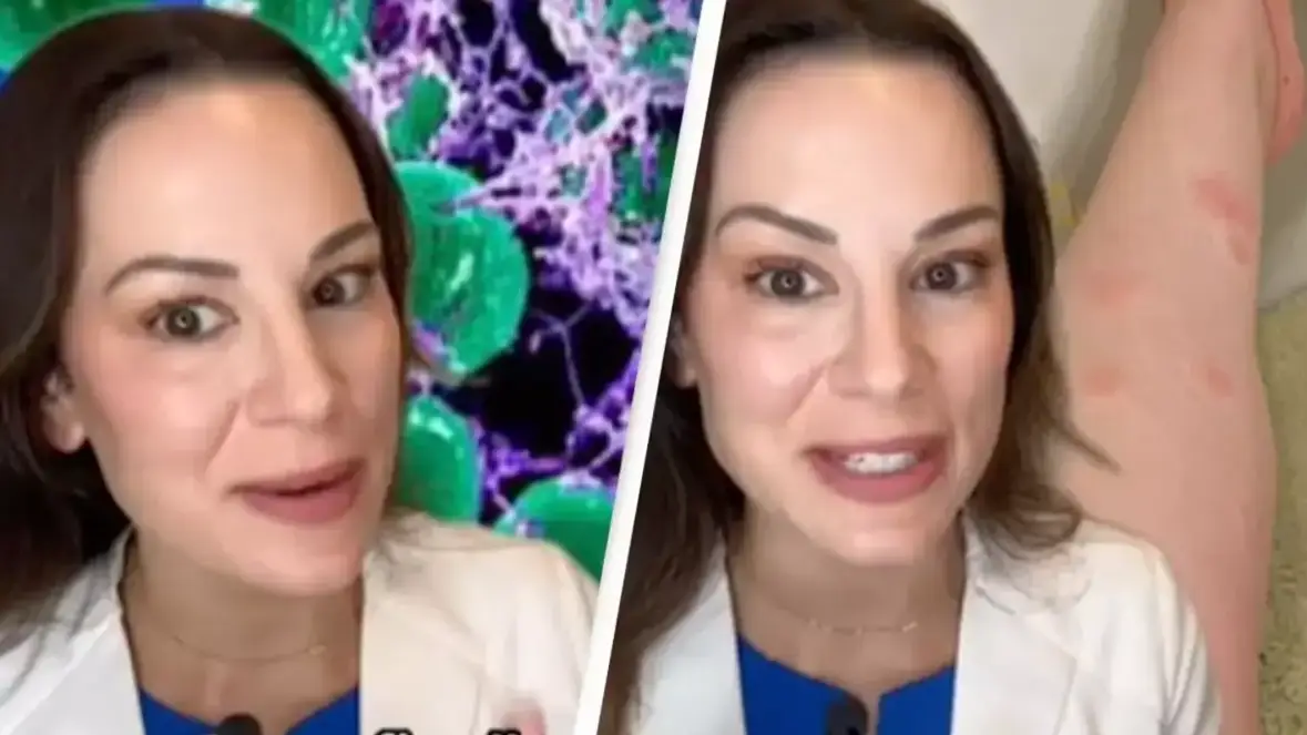 Expert reveals gross reason why mosquitoes like some people a lot more than others