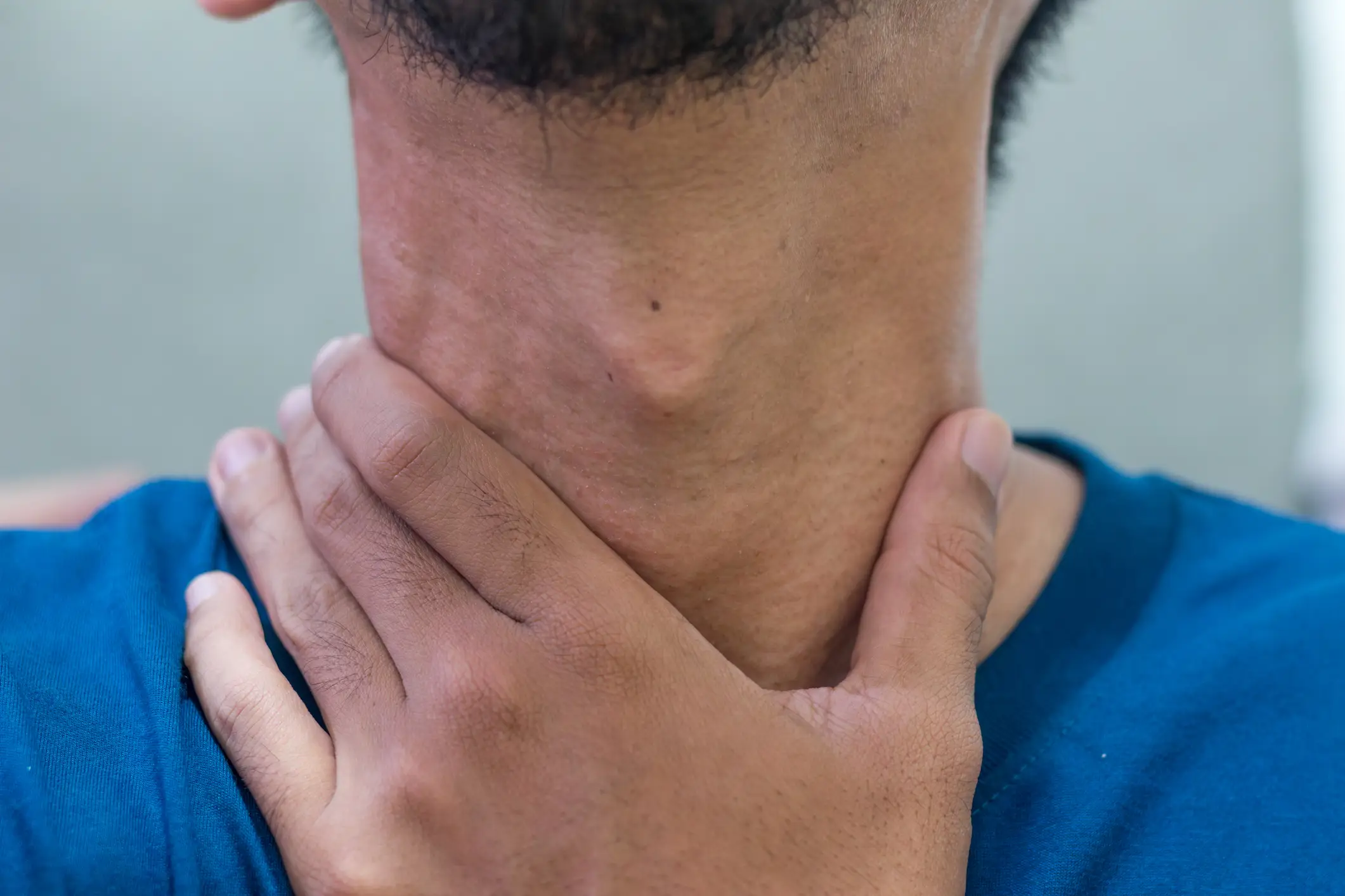 Thyroid issues can manifest via our hair (Fadfebrian/Getty Images)