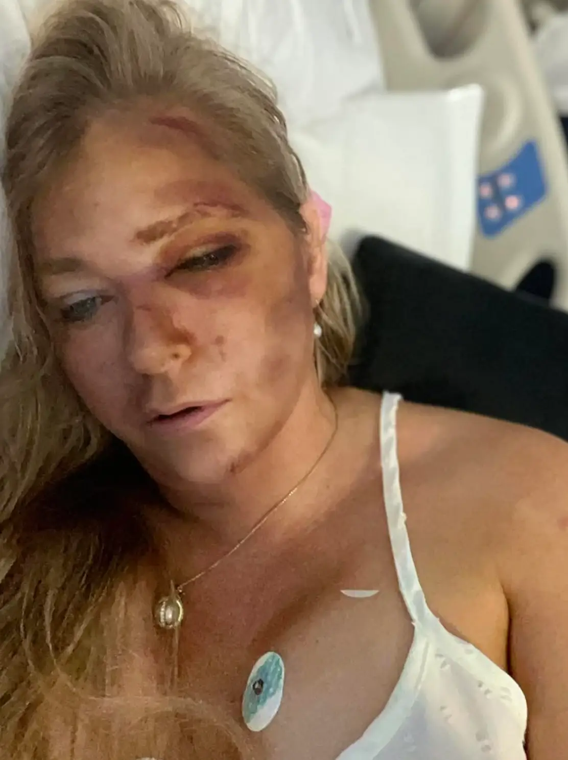Virginia Giuffre is reportedly fighting for her life (virginiarobertsrising11/Instagram)