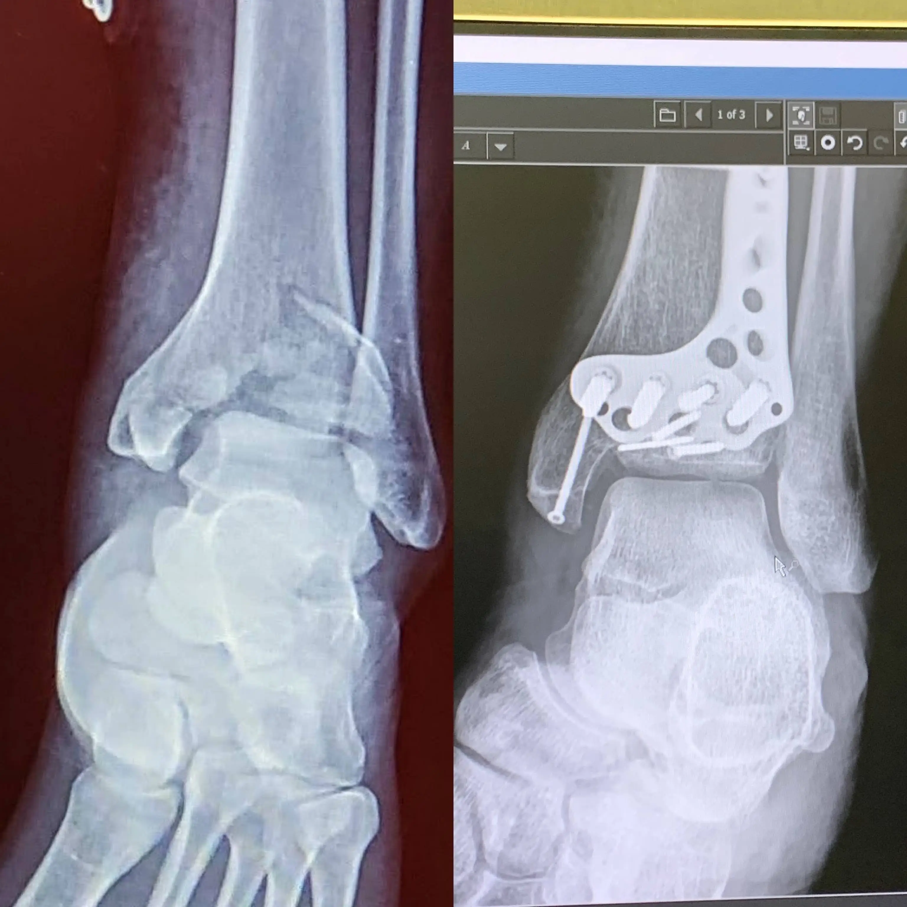 Jordan's injuries could have been a lot worse. (Supplied)