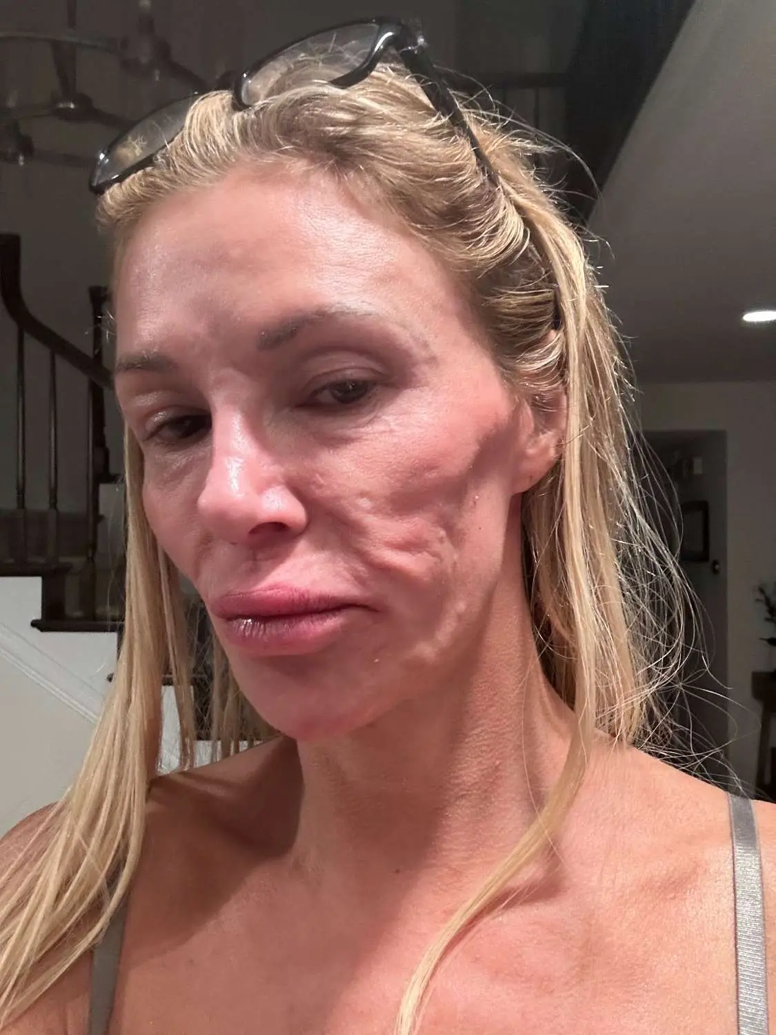 The star has opened up about her recent health diagnosis after 'years' of pushing for answers. (Brandi Glanville/X)