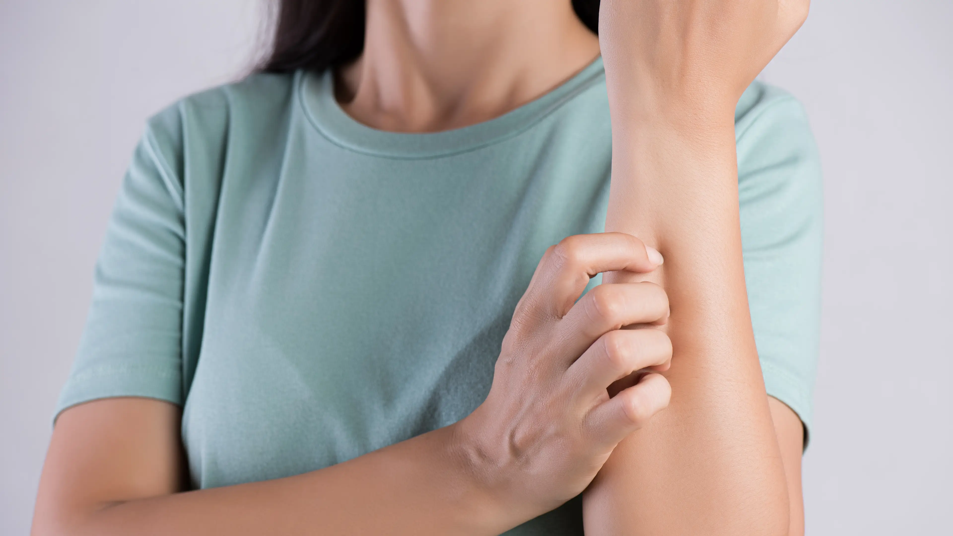 The real reason so many people seem to have the same freckle — and it's not a coincidence