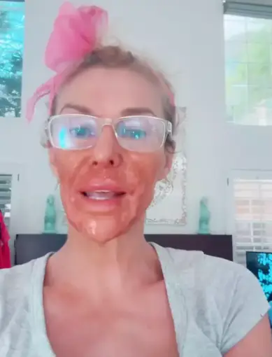 Brandi Glanville has spent a fortune trying to find out what's caused her facial problems (TikTok)