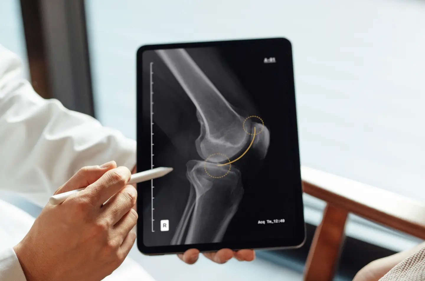 Joe's bones are softer than normal. (Getty Stock Photo)