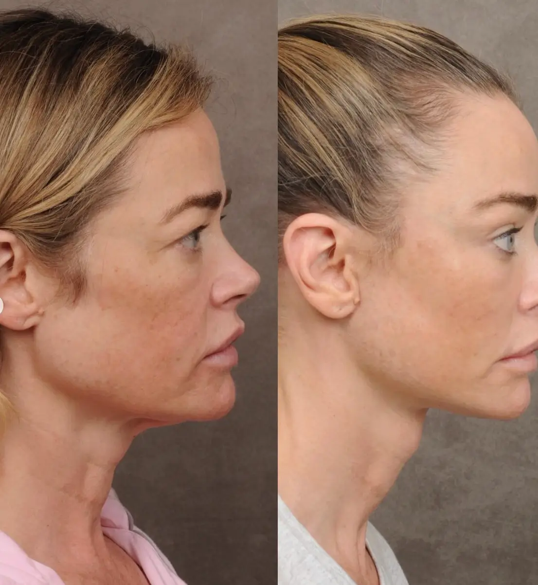 Richards called it the 'best thing I could've done for myself' (Instagram/@drbentalei)