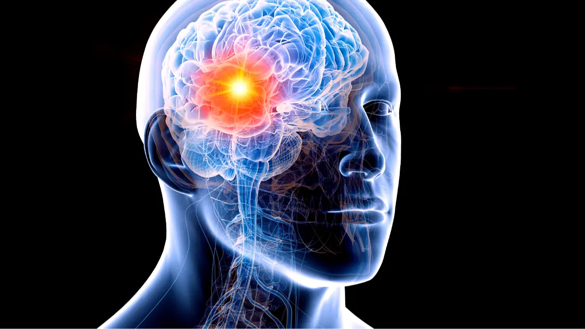 SEBASTIAN KAULITZKI/SCIENCE PHOTO LIBRARY/Getty