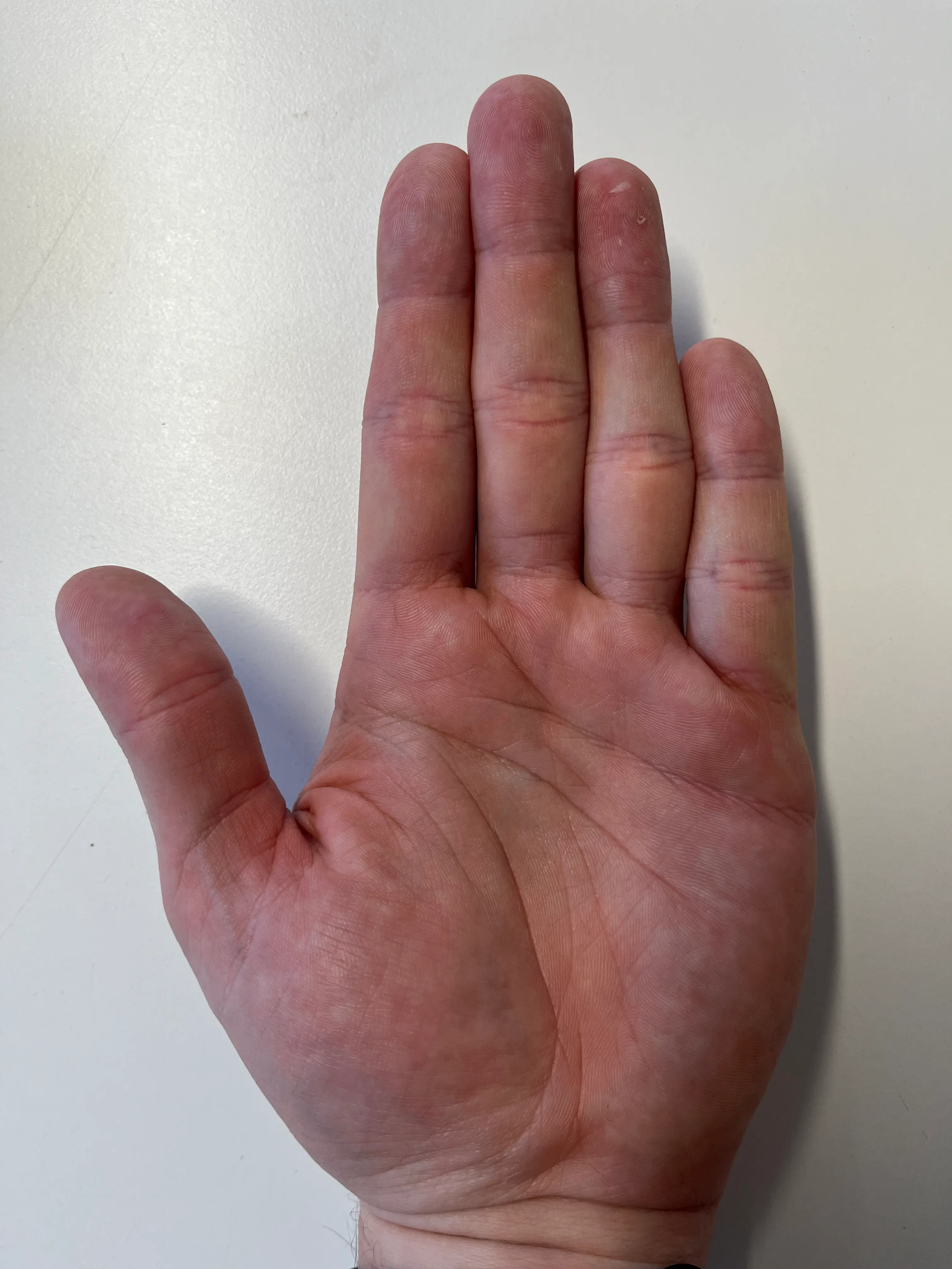 If your ring finger is bigger than your index finger you are more likely to run a marathon, according to the new paper (UNILAD)