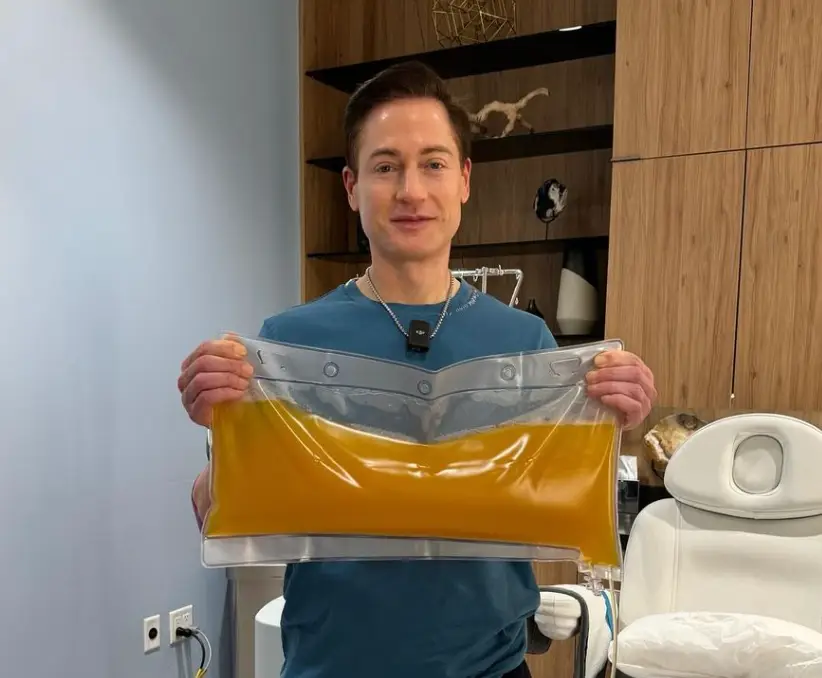 Bryan Johnson recently had all of his plasma removed (Instagram/@bryanjohnson_)