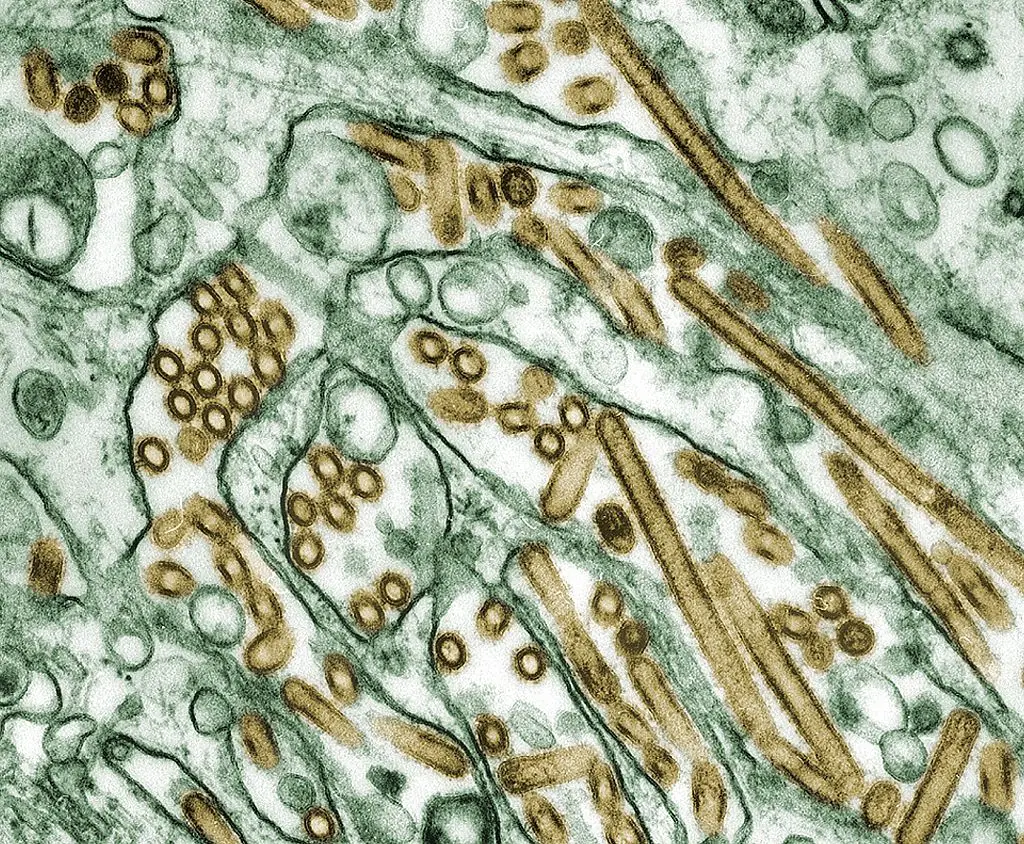 The H5N1 bird flu virus (Smith Collection/Gado/Getty Images)