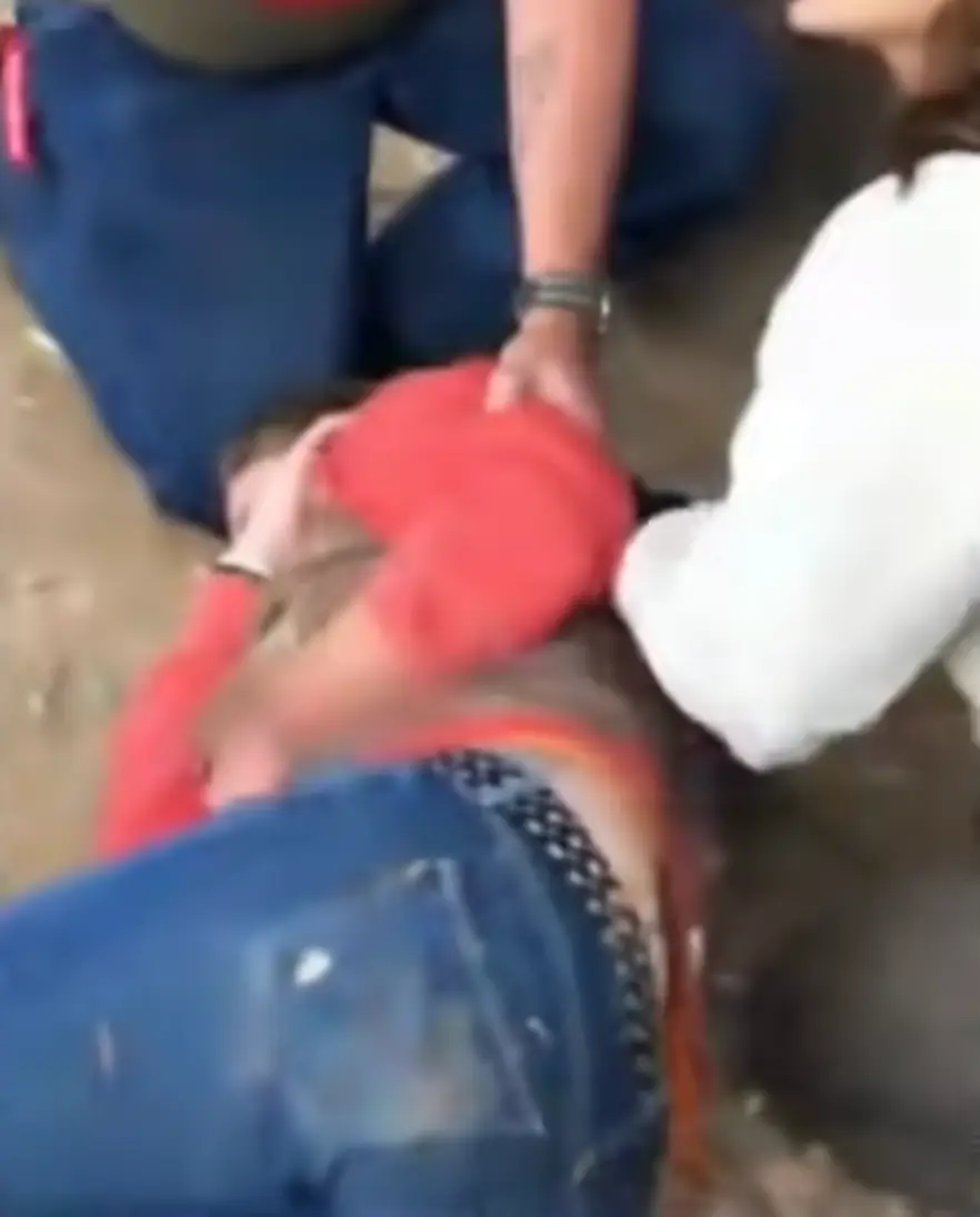 The woman received huge gashes and scratches from the jaguar. (ABC News)