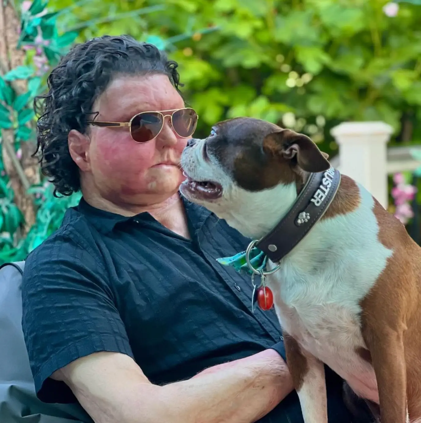 Joe DiMeo had a face and double hand transplant in 2020 (Instagram/@joeroydimeo)