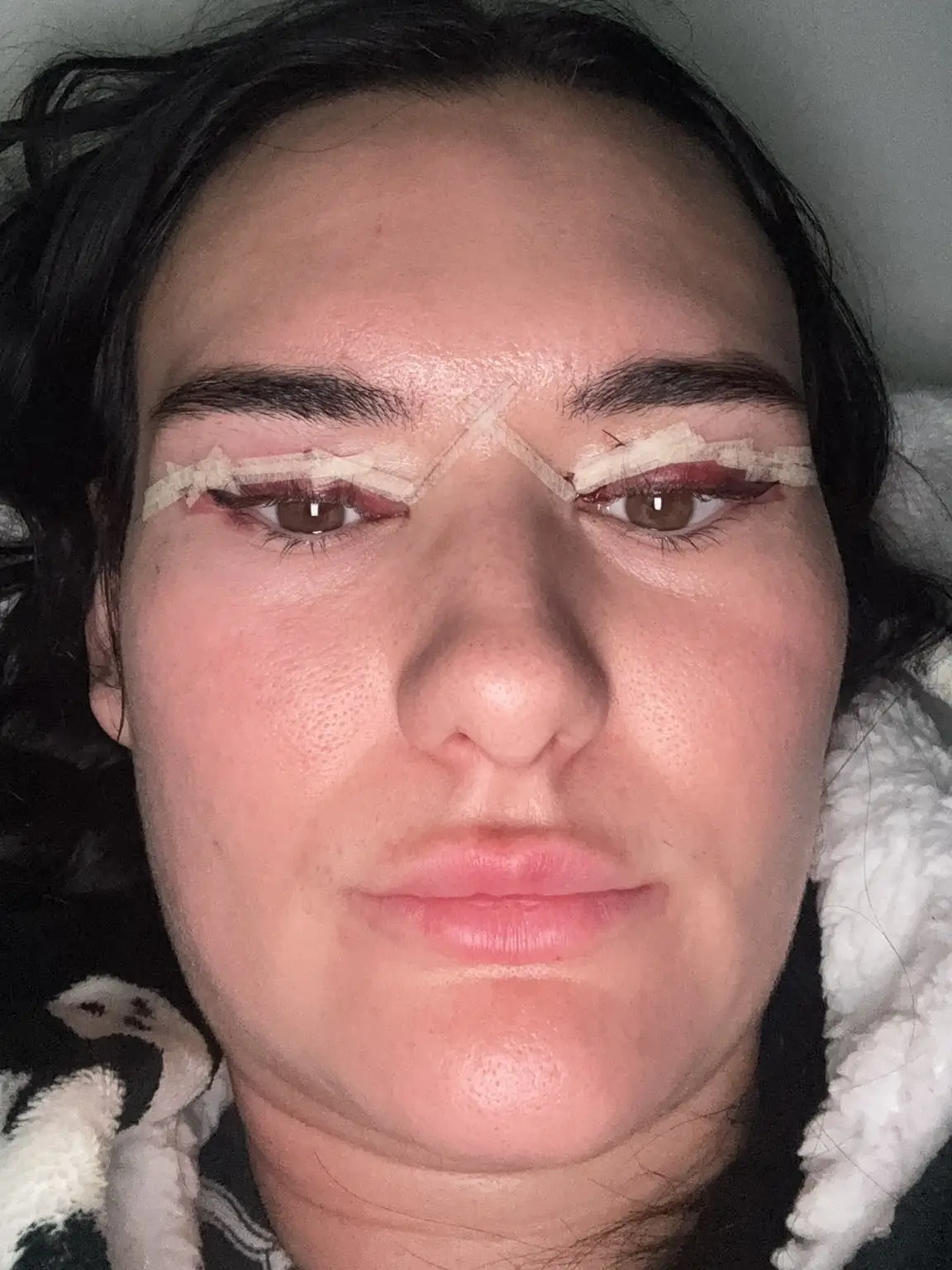 She decided to fly to Germany for the procedure. (SWNS)