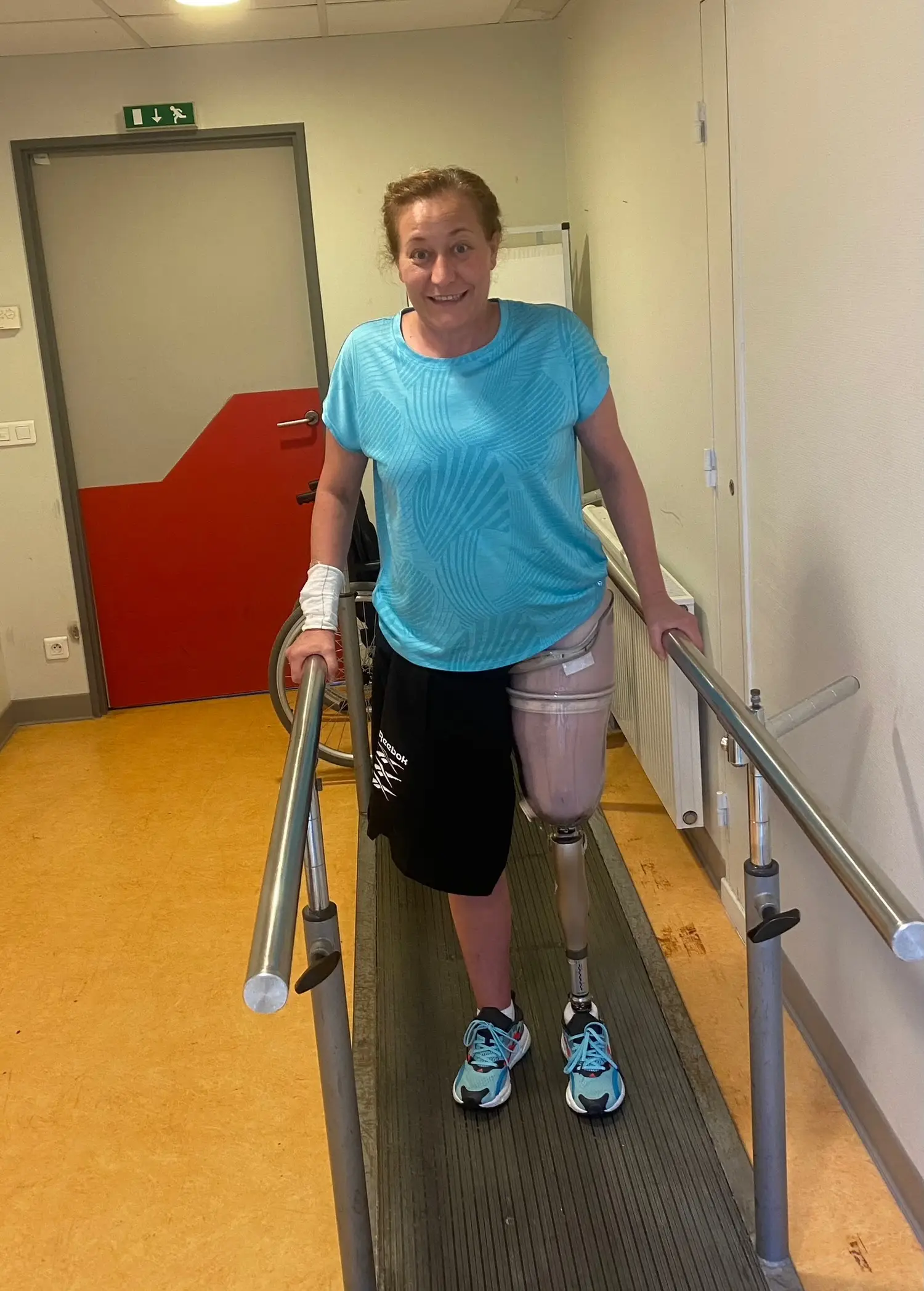 The 51-year-old had to learn to walk with a prosthetic (PA Real Life)