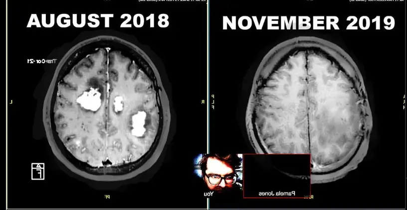 Bottenus shared a health update with followers in 2020 (Instagram/ @astralgrandad) 