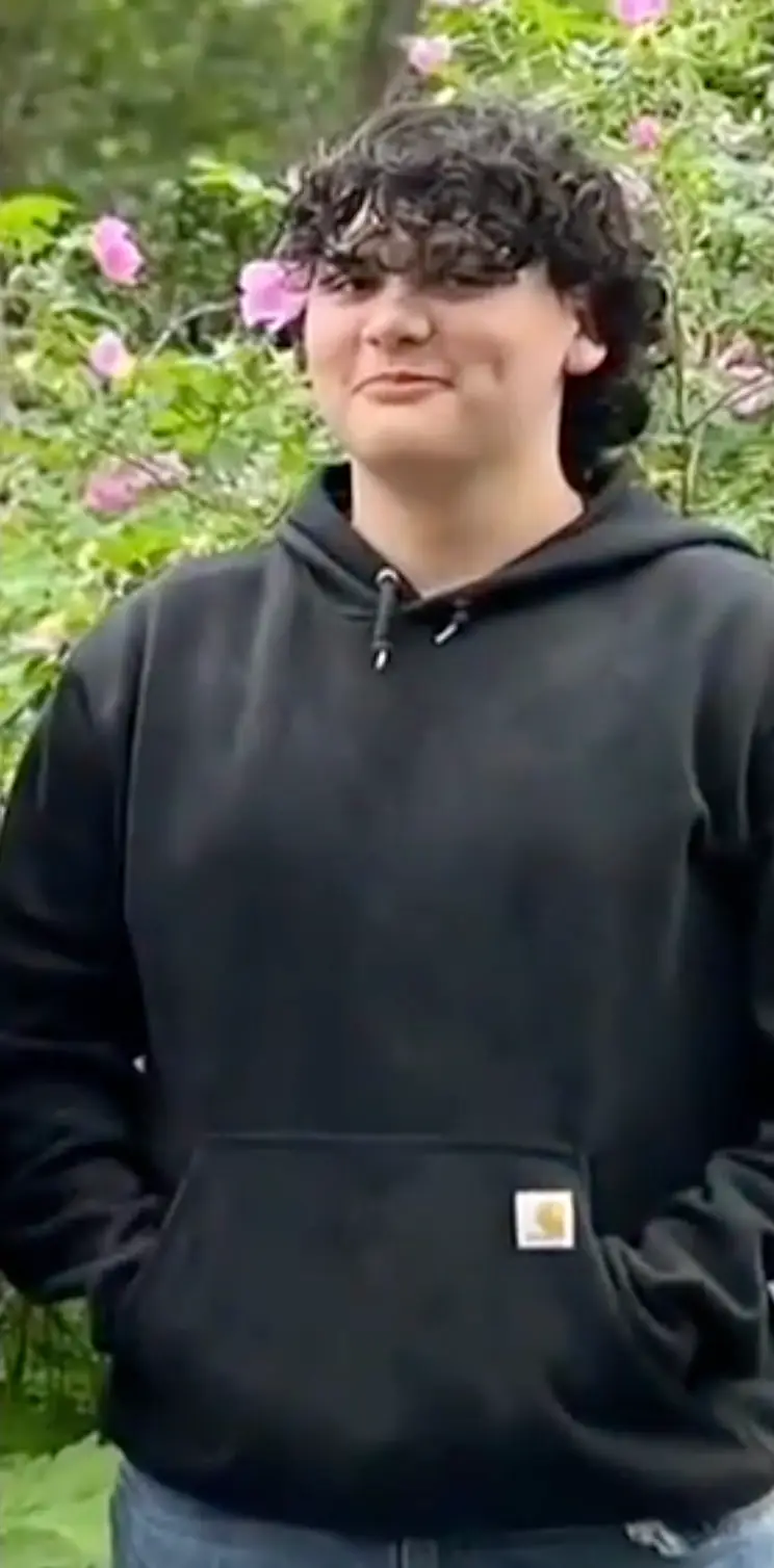 Kavik Wolfe sustained third-degree burns to his hands and second-degree burns to his face and body (Alaska News Source)