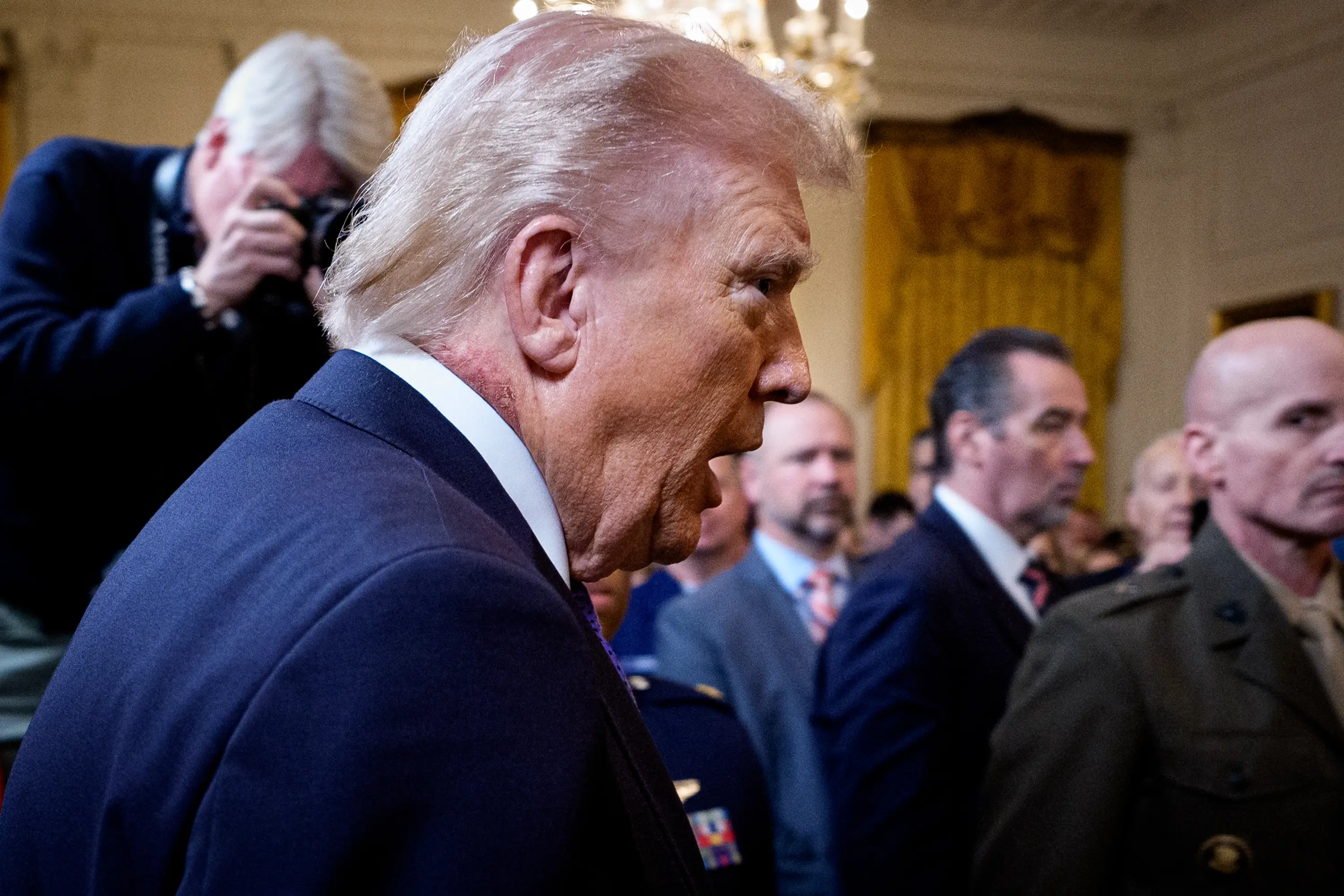 The rash could be seen on the president's neck (Andrew Harnik/Getty Images)