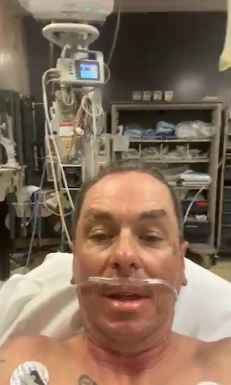 Despite suffering serious burns, Slipknot has issued a statement saying Wilson will be on stage to open the tour on September 1. (sidthe3rd/Instagram)