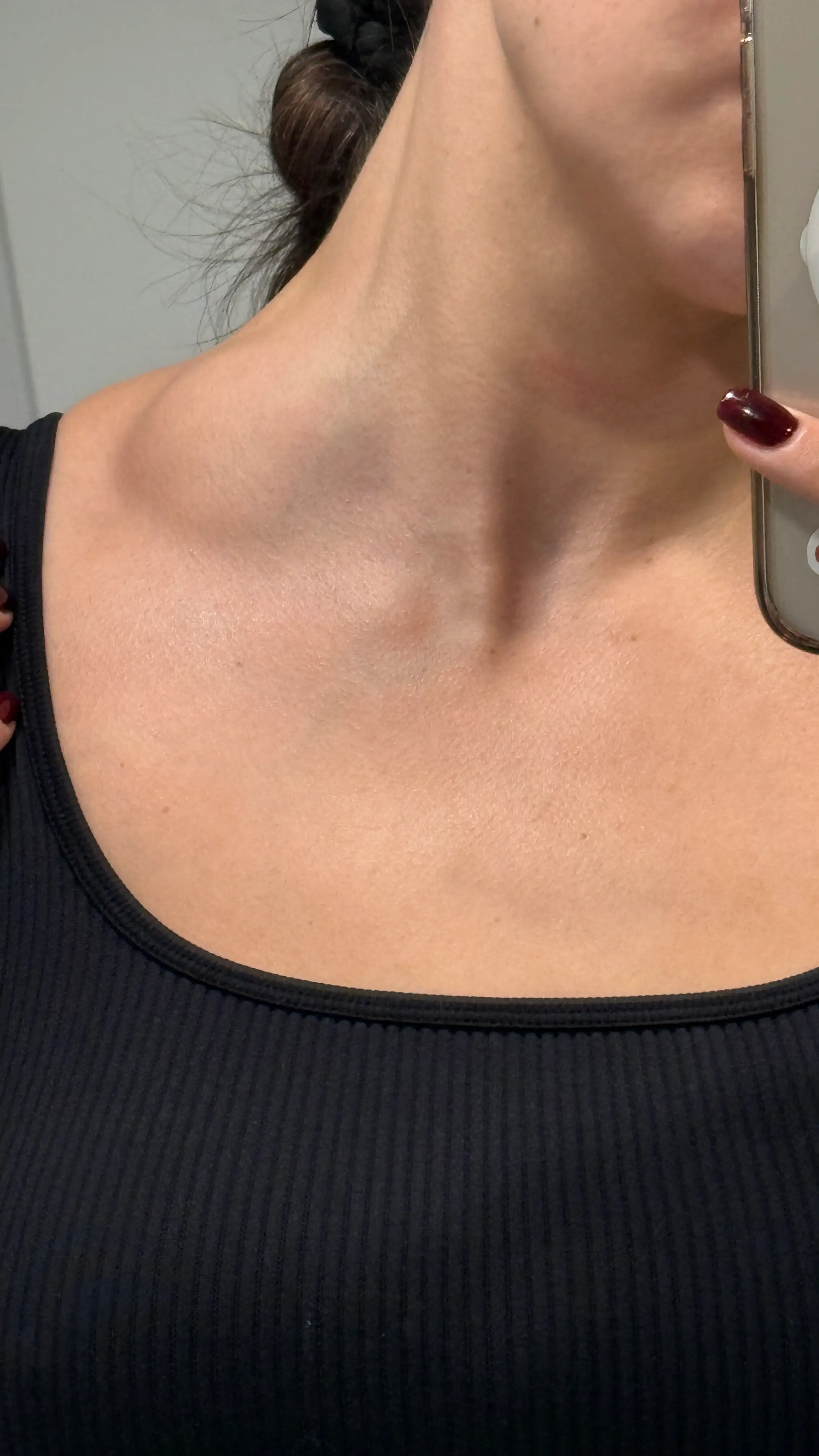 Kayla soon noticed lumps on her neck (Supplied)