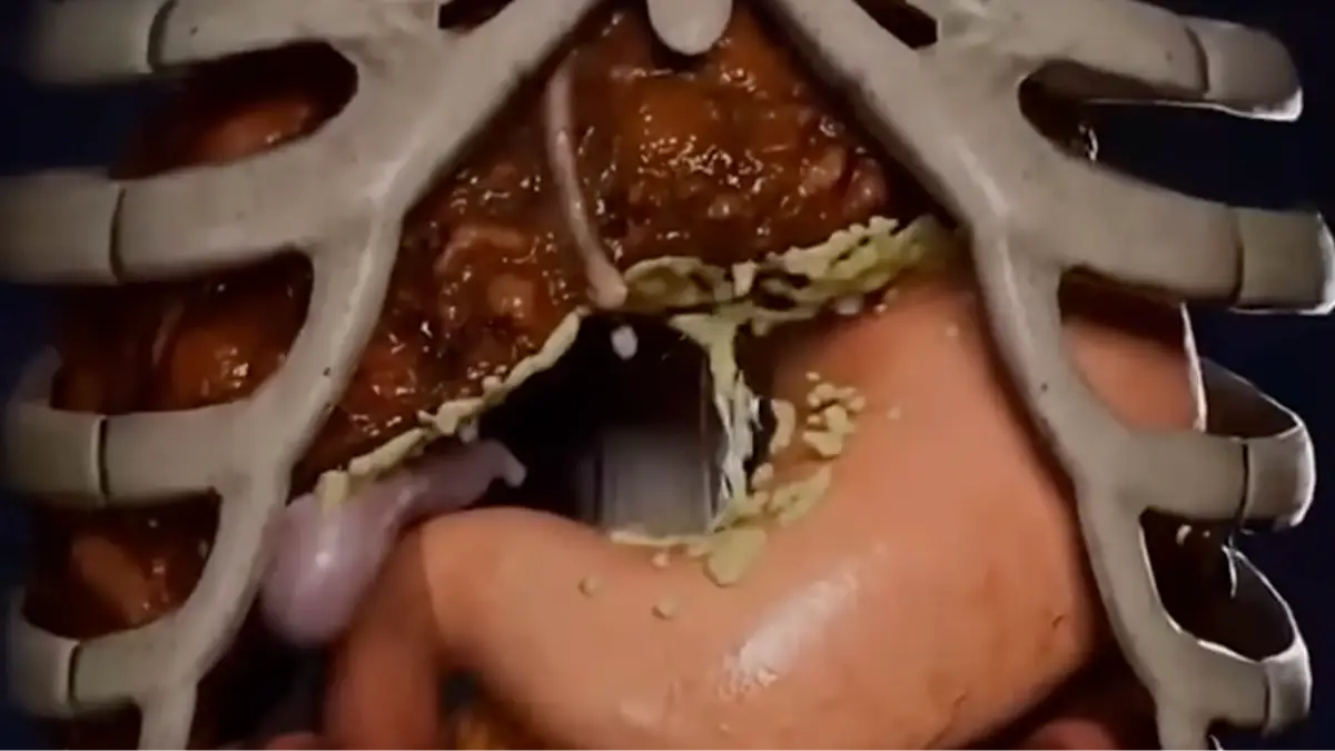 YouTube/wellneswise4