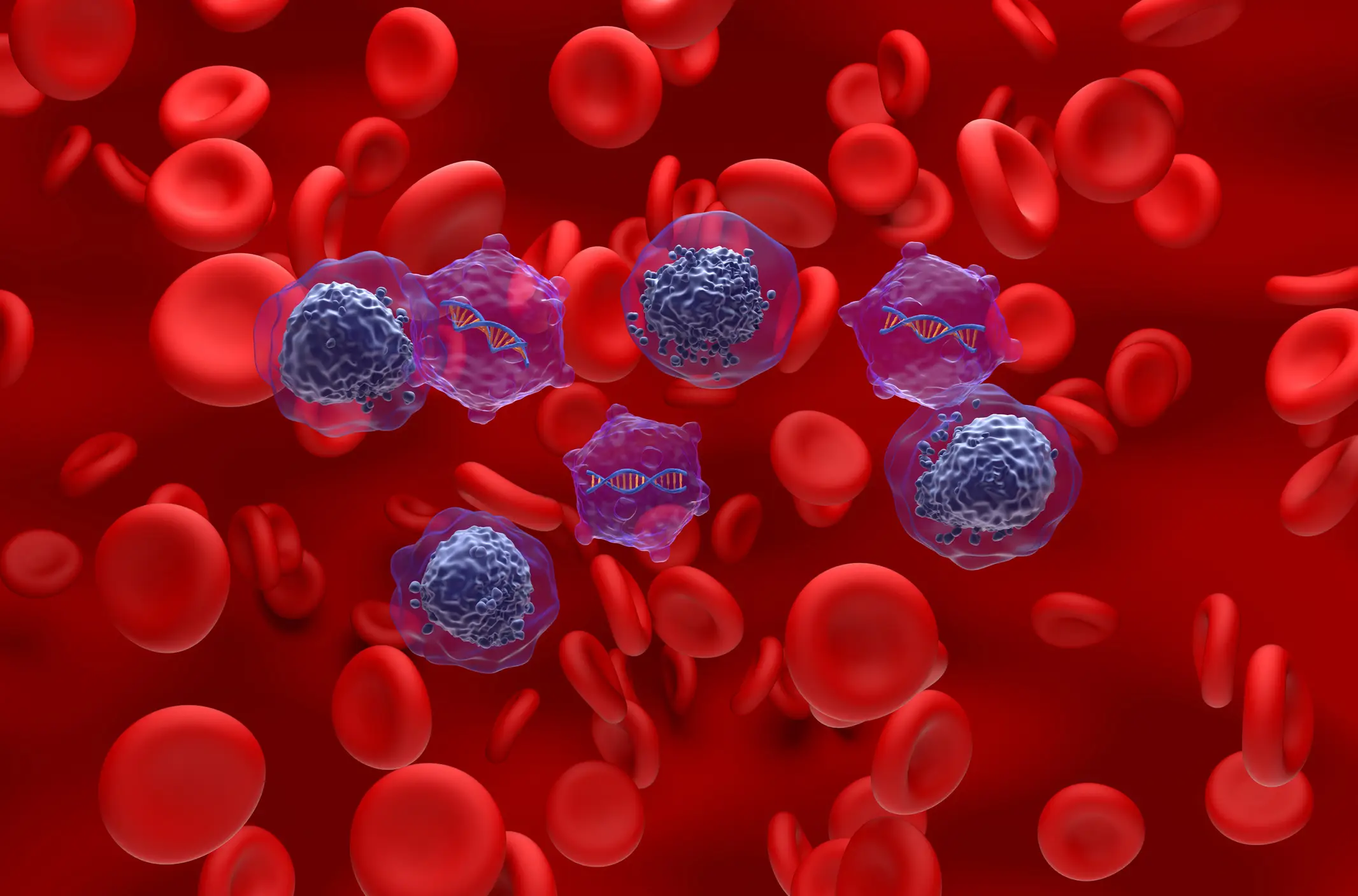 Some 20,000 new cases of AML are diagnosed every year in the US (Nemes Lazlo/Getty Images)