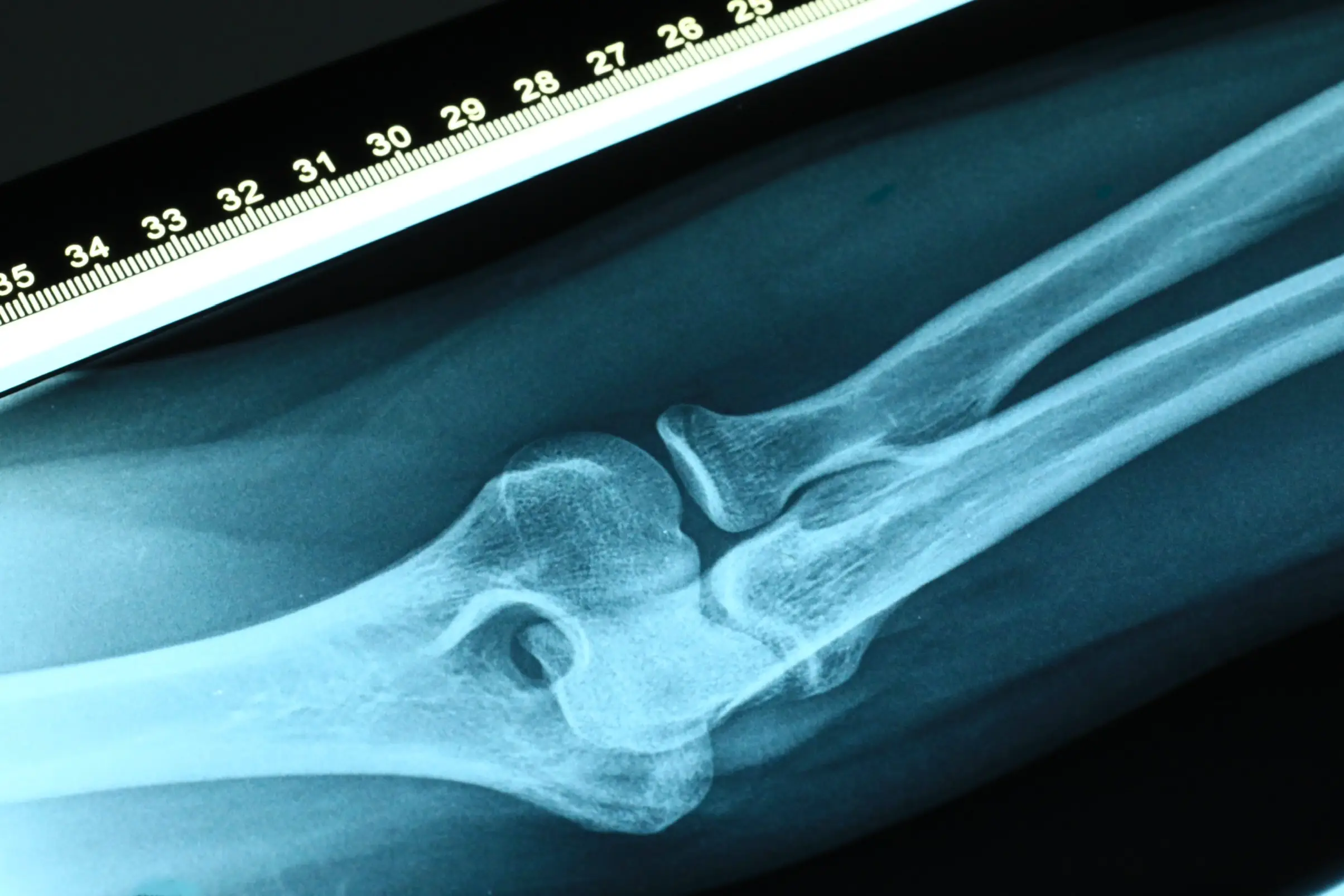 The doctor has debunked the claims. (Getty Stock Images)