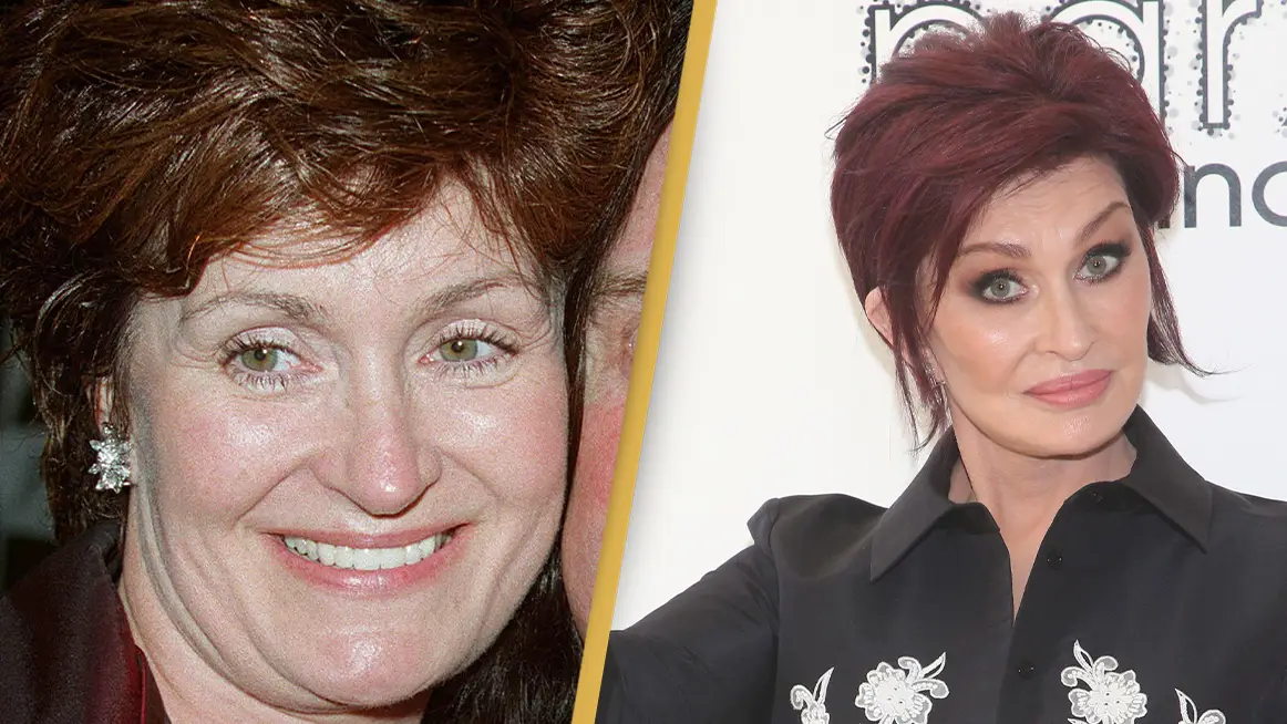 Sharon Osbourne admits she pushed it ‘too f**king hard’ with plastic surgery