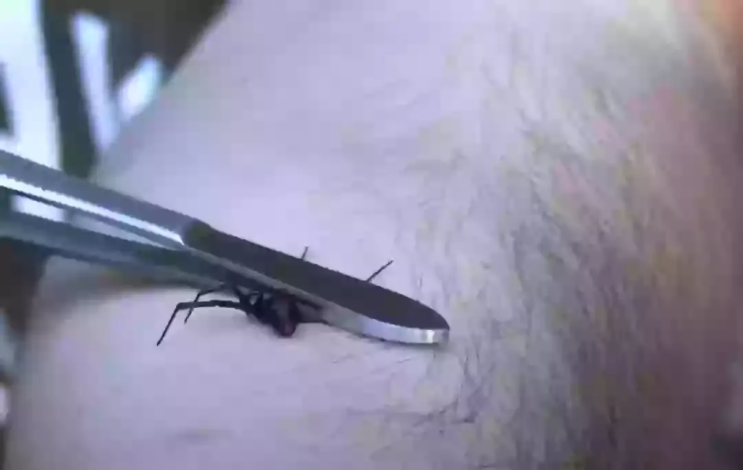 The YouTuber put the spider bite to the test (Jack's World of Wildlife/YouTube)
