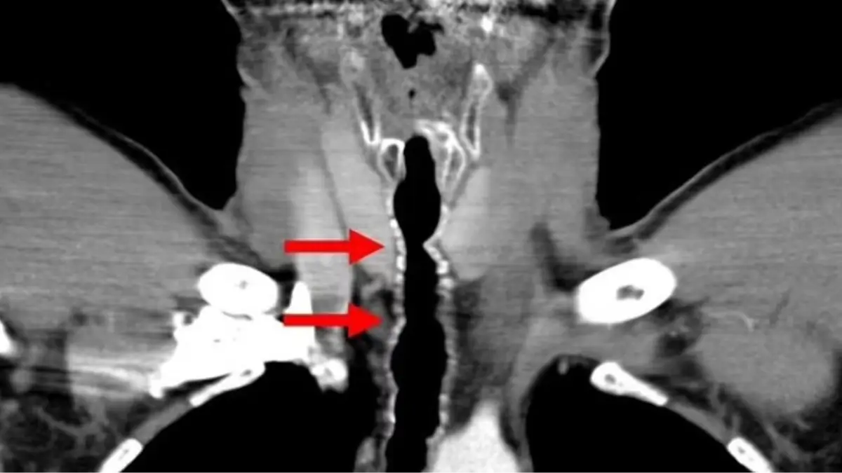 American Journal of Case Reports