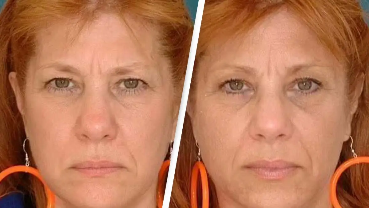 Dr. Bahman Guyuron / American Society of Plastic Surgeons