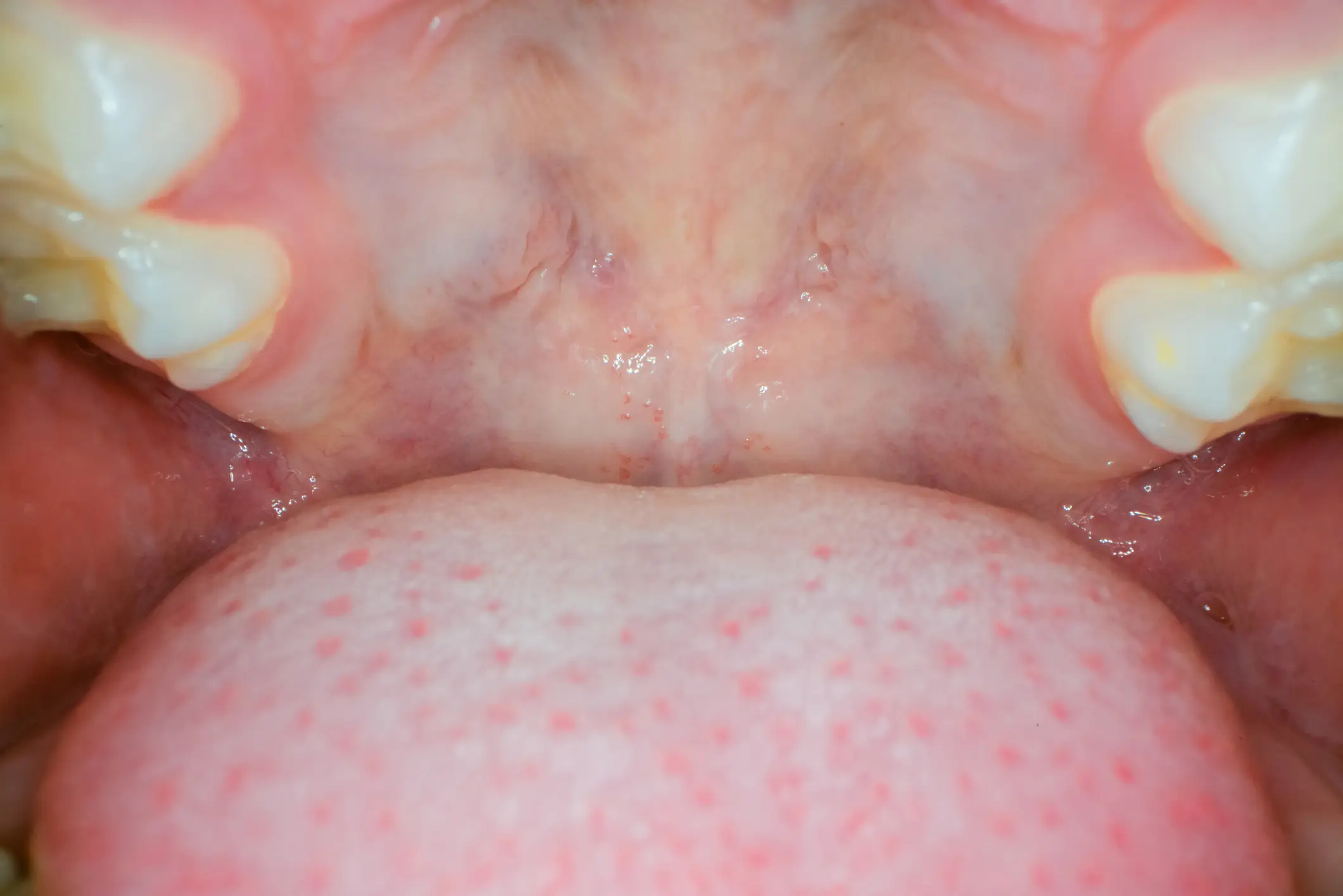 There are symptoms you can easily miss (Getty Stock Image)