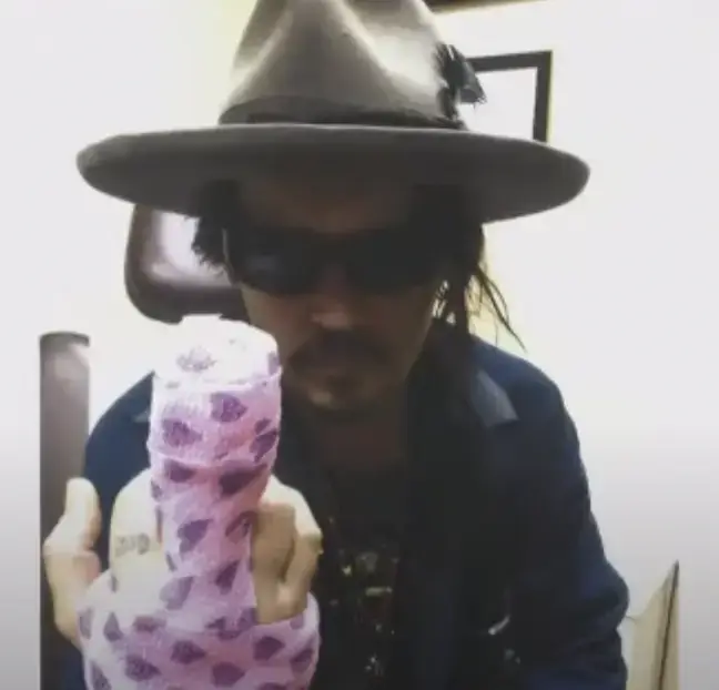 Johnny Depp showing off his injured finger.