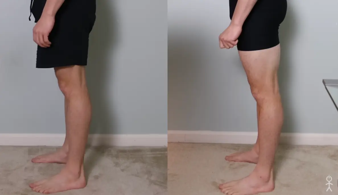 The leg pain was real (YouTube/FocusedLucas)