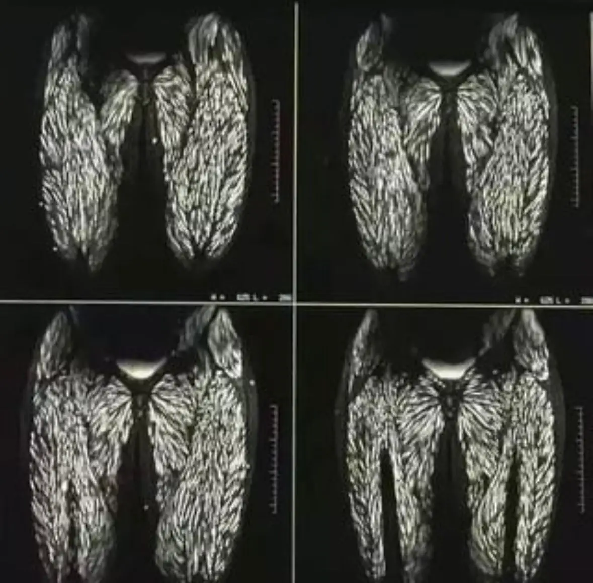 The woman's condition after the parasites were discovered is unknown. (Twitter/@PicturesFoIder)