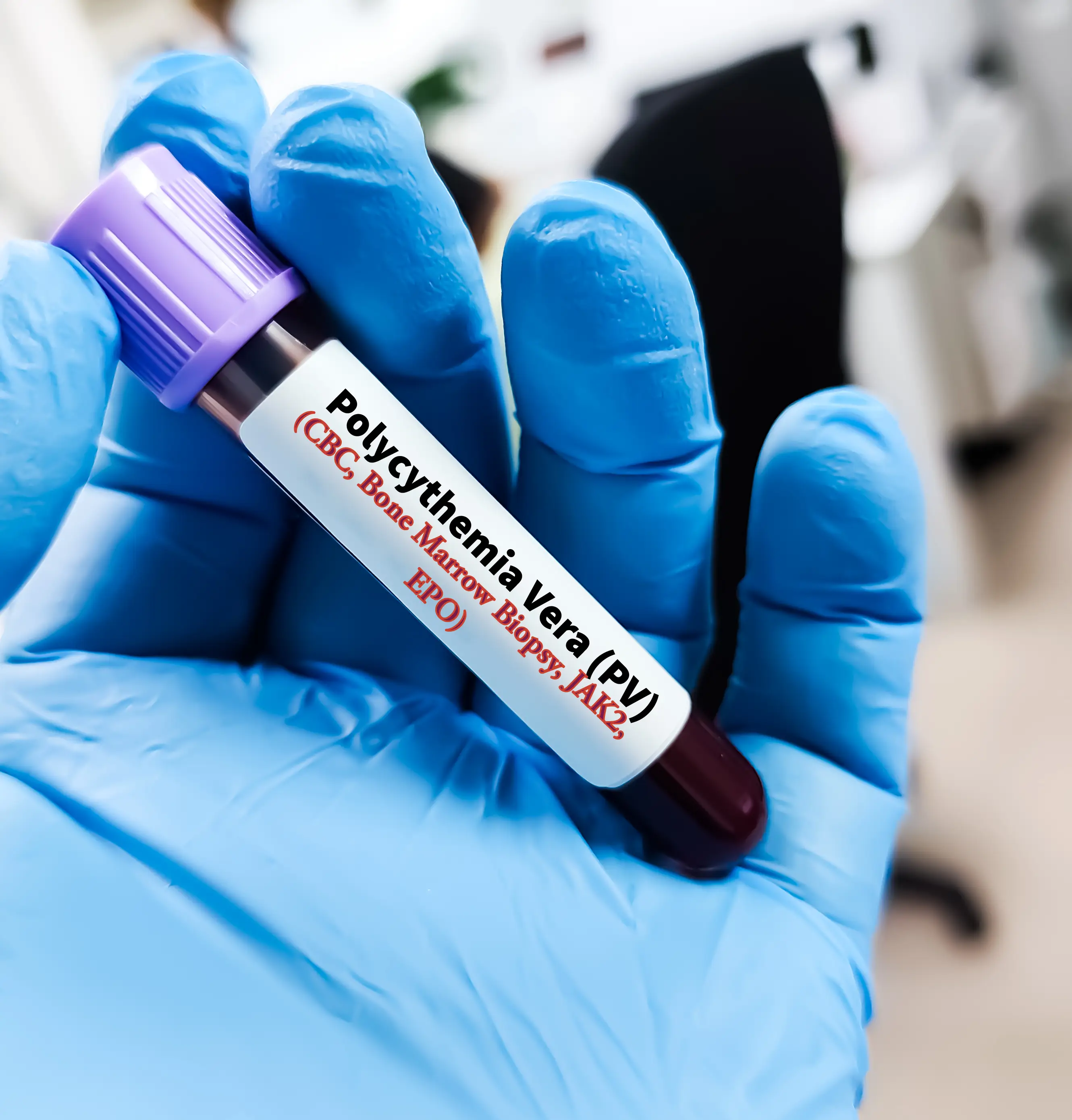 Itching can be mistaken for other issues (Getty Stock Images)