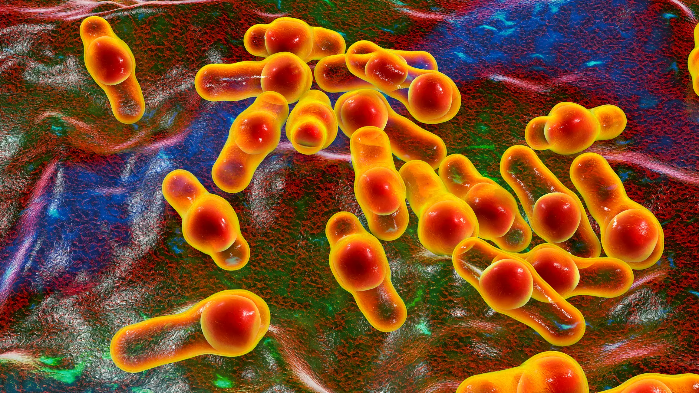 Foodborne botulism can be deadly if not treated (Kateryna Kon/Science Photo Library/Getty Images)