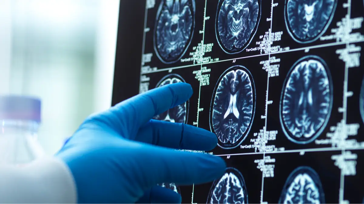 Getty Images/Andrew Brookes