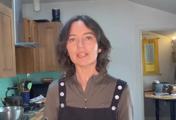 The condition affects one in 33 people. (Instagram/@eleanor.flegg)