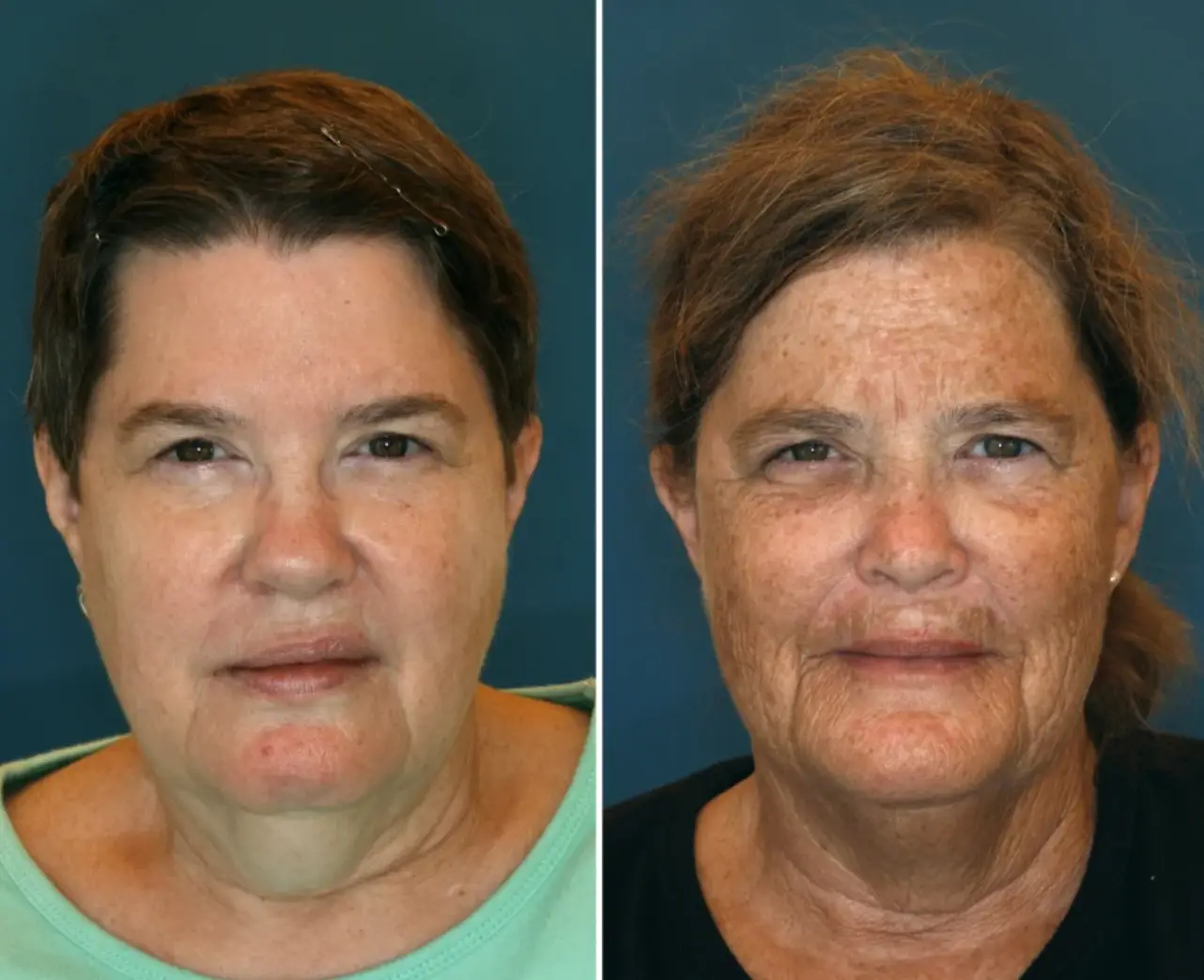 Jeanne (left) said her sister looked 'ten years older' (NBC)