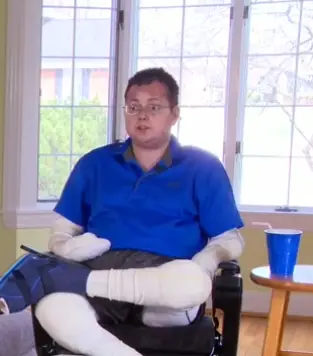 Shane DiGiovanna lives with Epidermolysis Bullosa (WKRC)